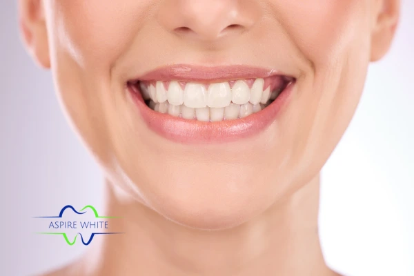 Follow your teeth whitening aftercare Corby to prolong your whiter smile!