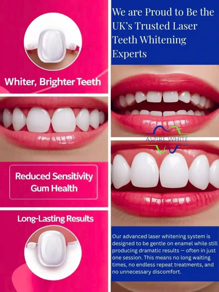 We are Proud to Be the UK’s Trusted Laser Teeth Whitening Experts Corby